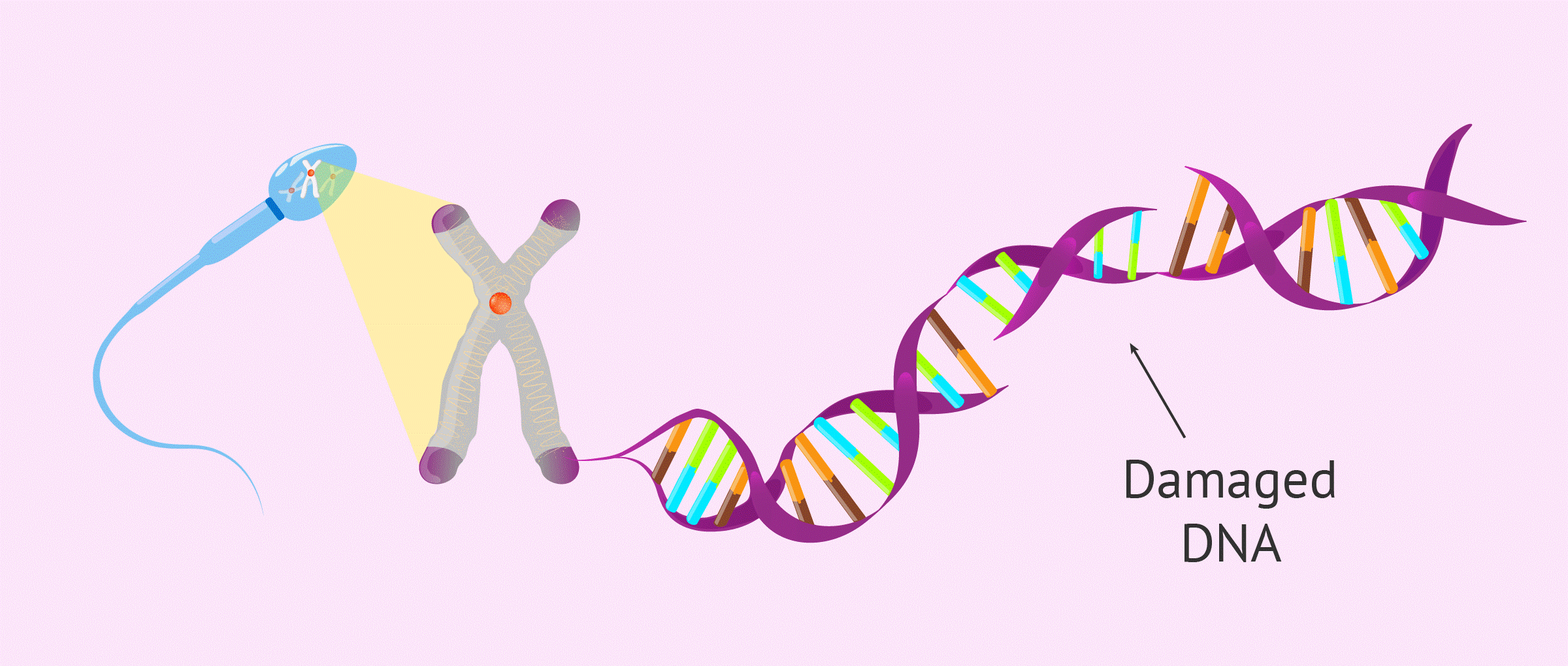 Đứt gãy DNA tinh trùng
