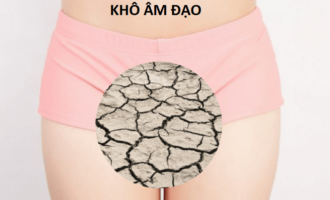 khô hạn sau sinh