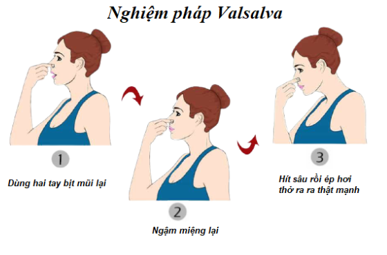 nghiệm pháp Valsalva