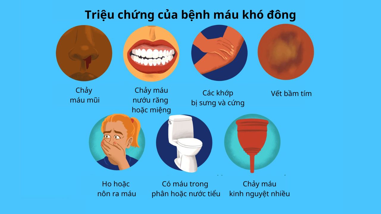 Bệnh máu không đông có chữa được không