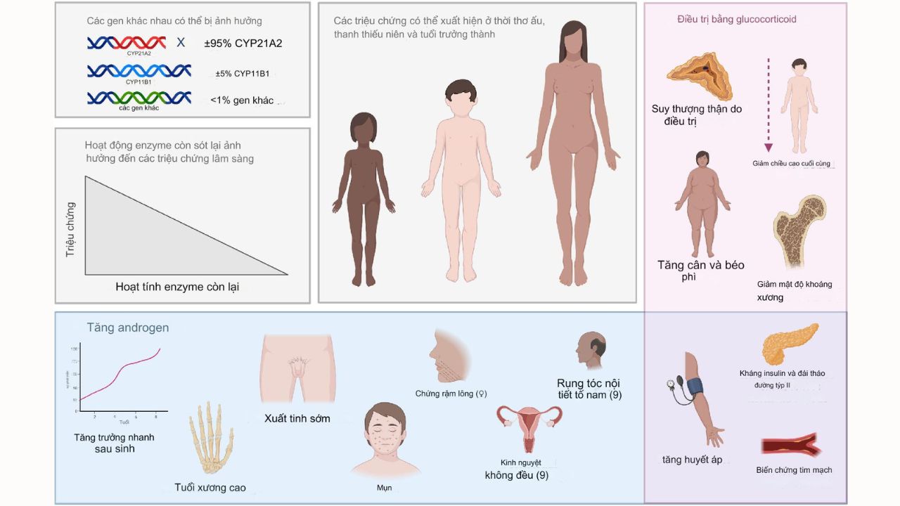 Bệnh tăng sản tuyến thượng thận bẩm sinh