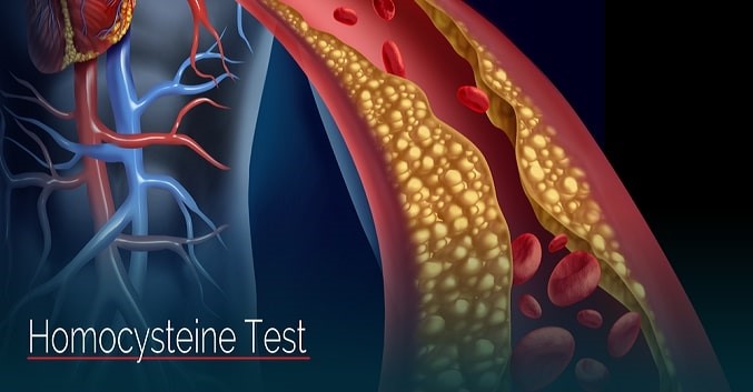 Kiểm soát nồng độ Homocysteine