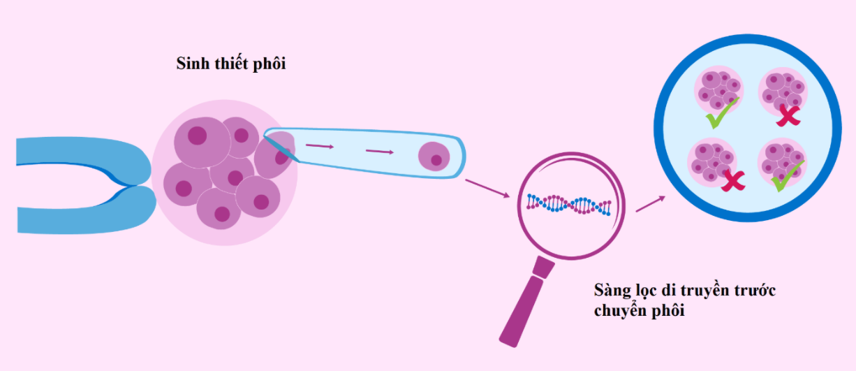 Kỹ Thuật PGT-M