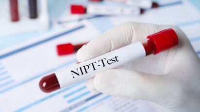 Xét nghiệm NIPT