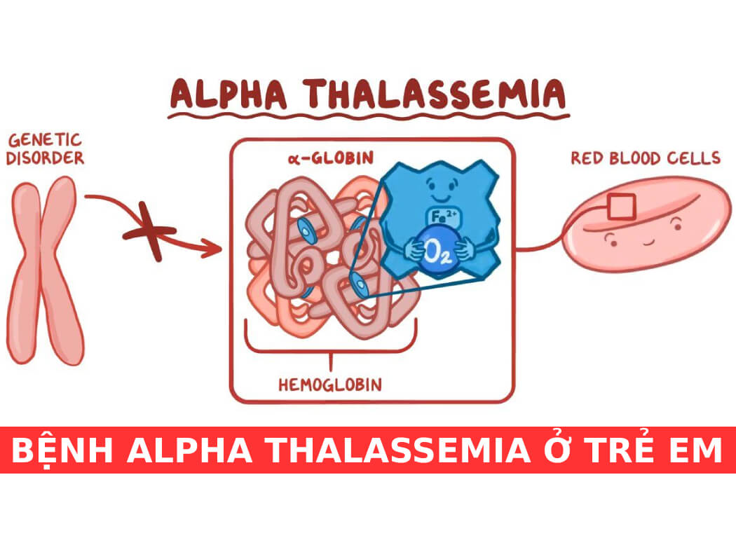 định nghĩa bệnh Thalassemia