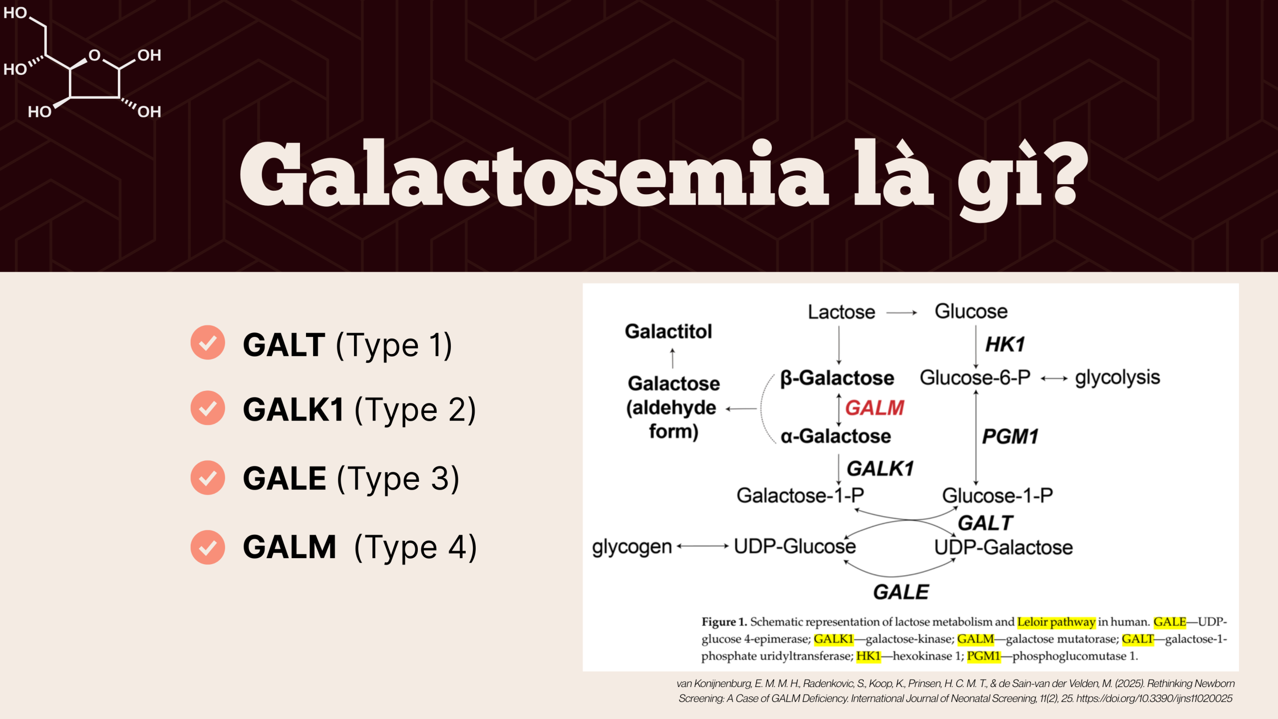 Rối loạn chuyển hóa đường Galactosemia