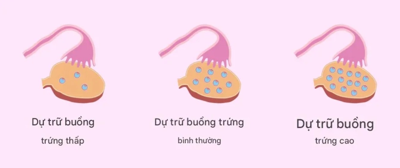 Dấu hiệu giảm dự trữ buồng trứng