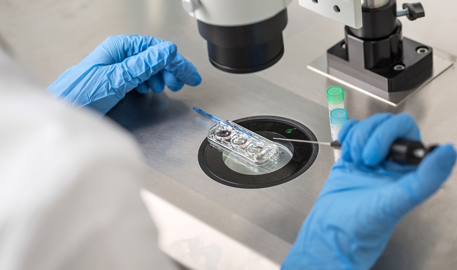 IVF mini bao nhiêu tiền