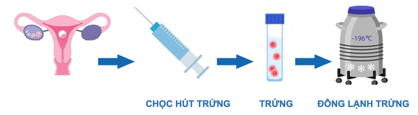 Quy trình chuyển phôi trữ đông