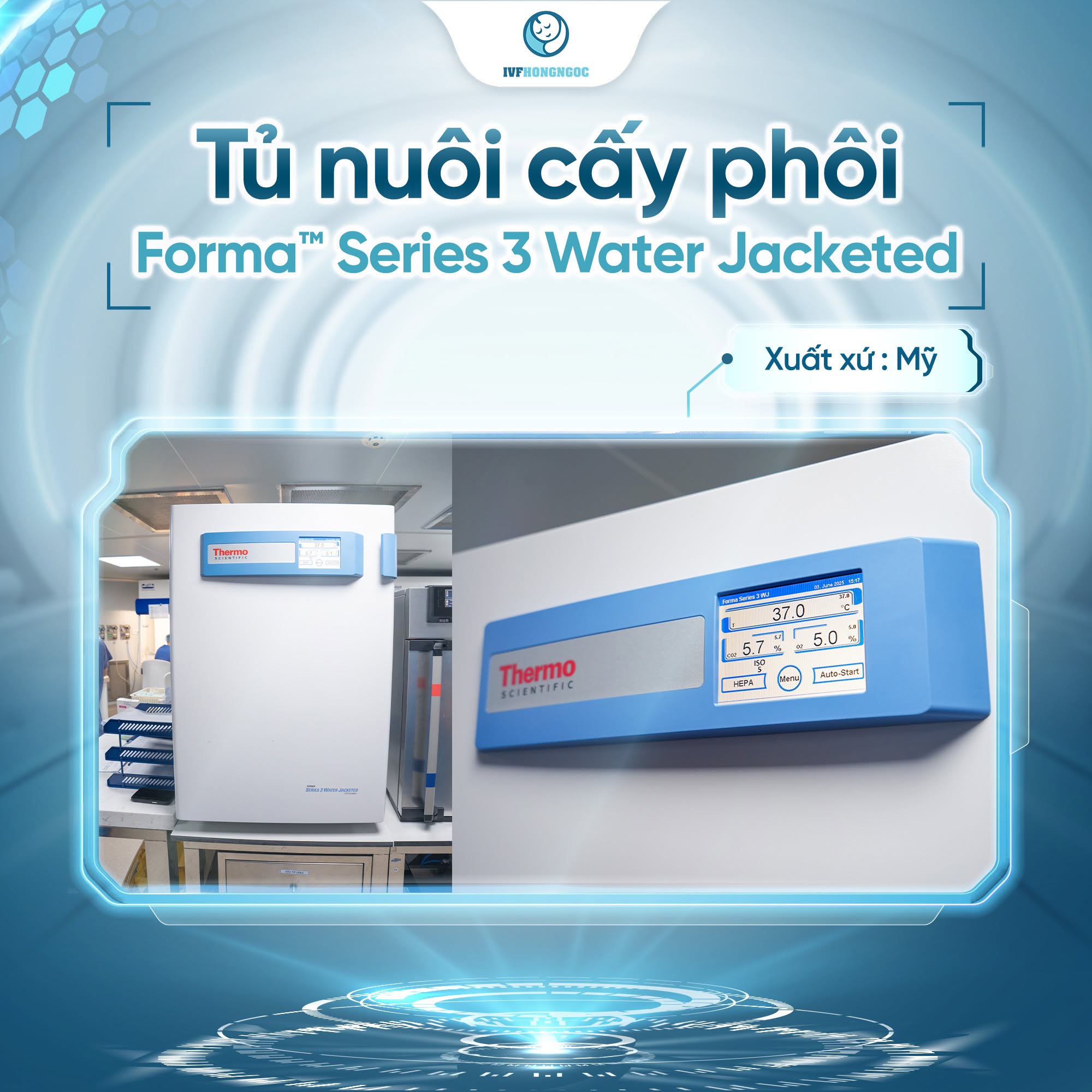 Tủ nuôi cấy phôi