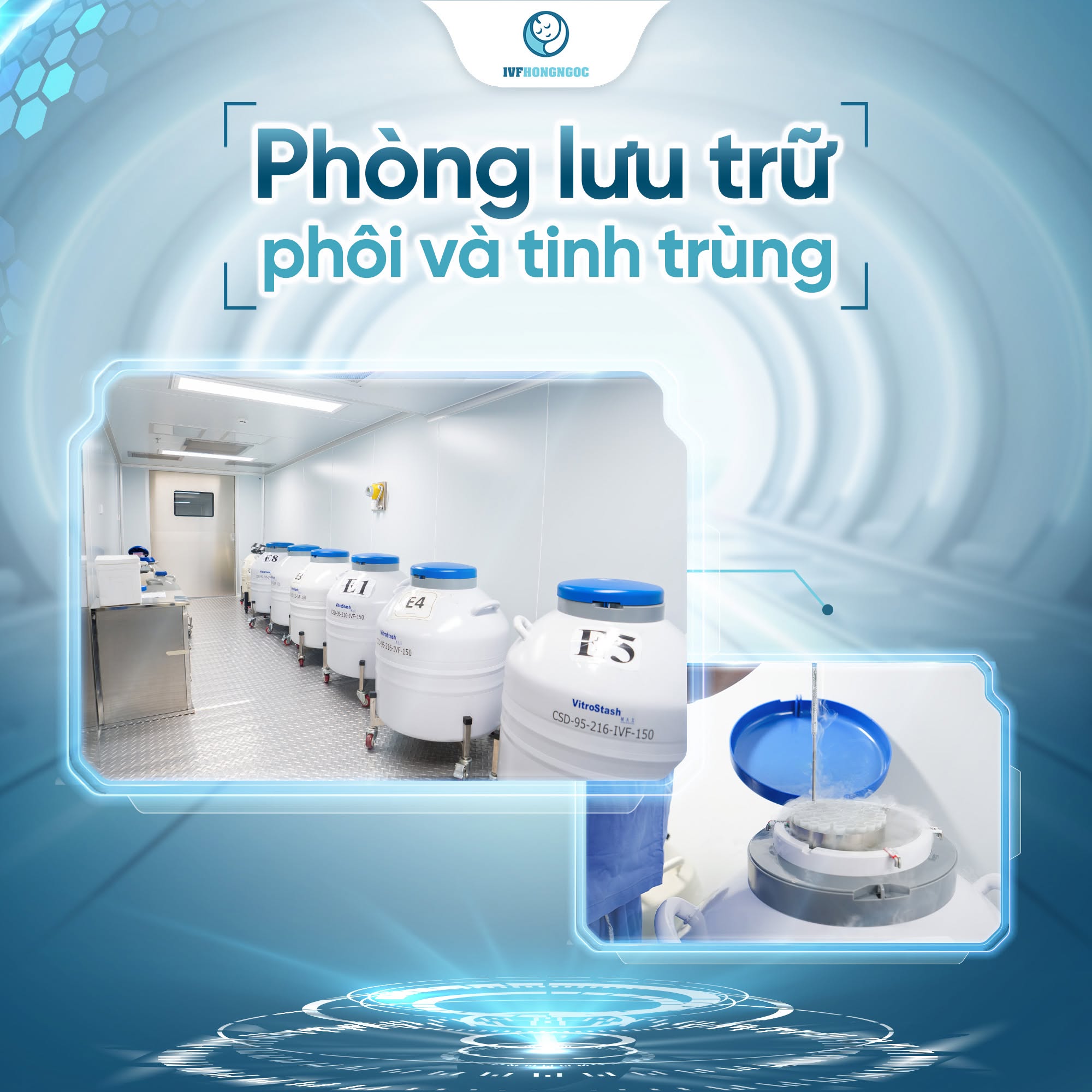 chuyển phôi IVF
