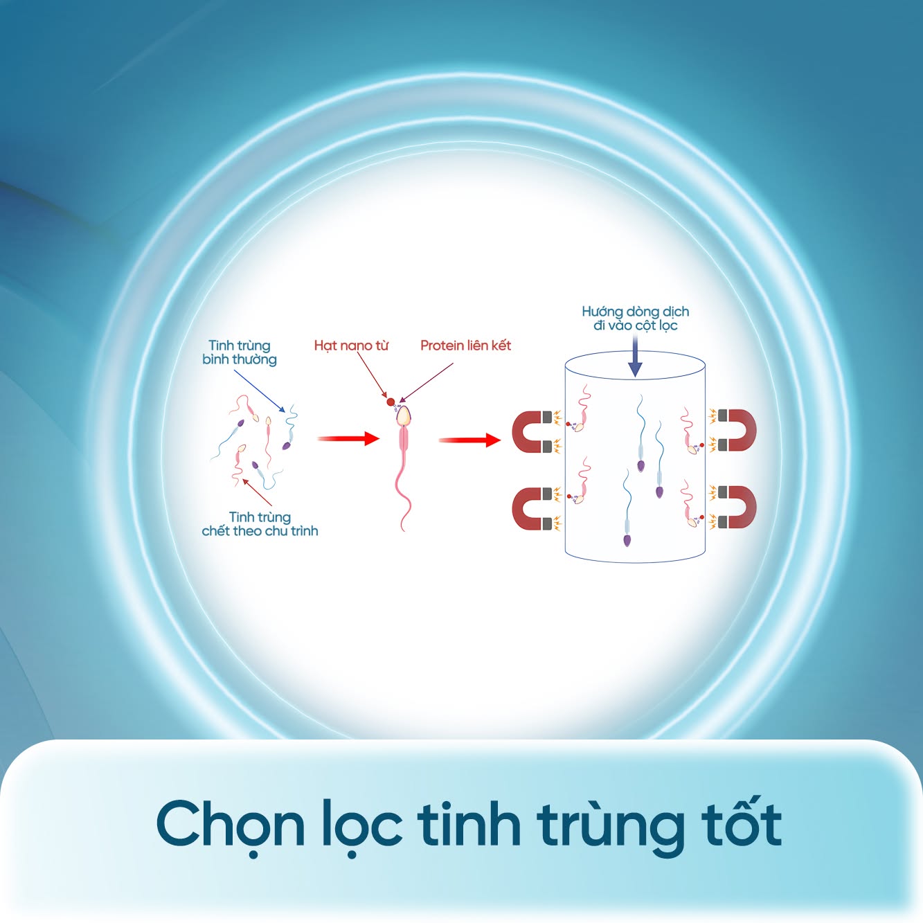 Sàng lọc tinh trùng từ trường hết bao nhiêu tiền